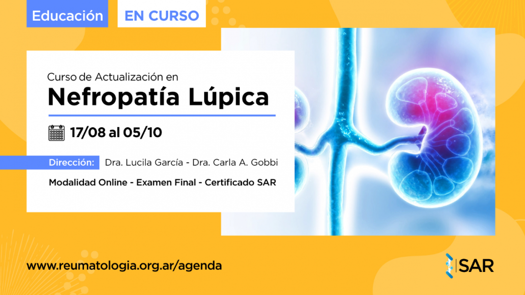 Actualización en Nefropatía Lúpica